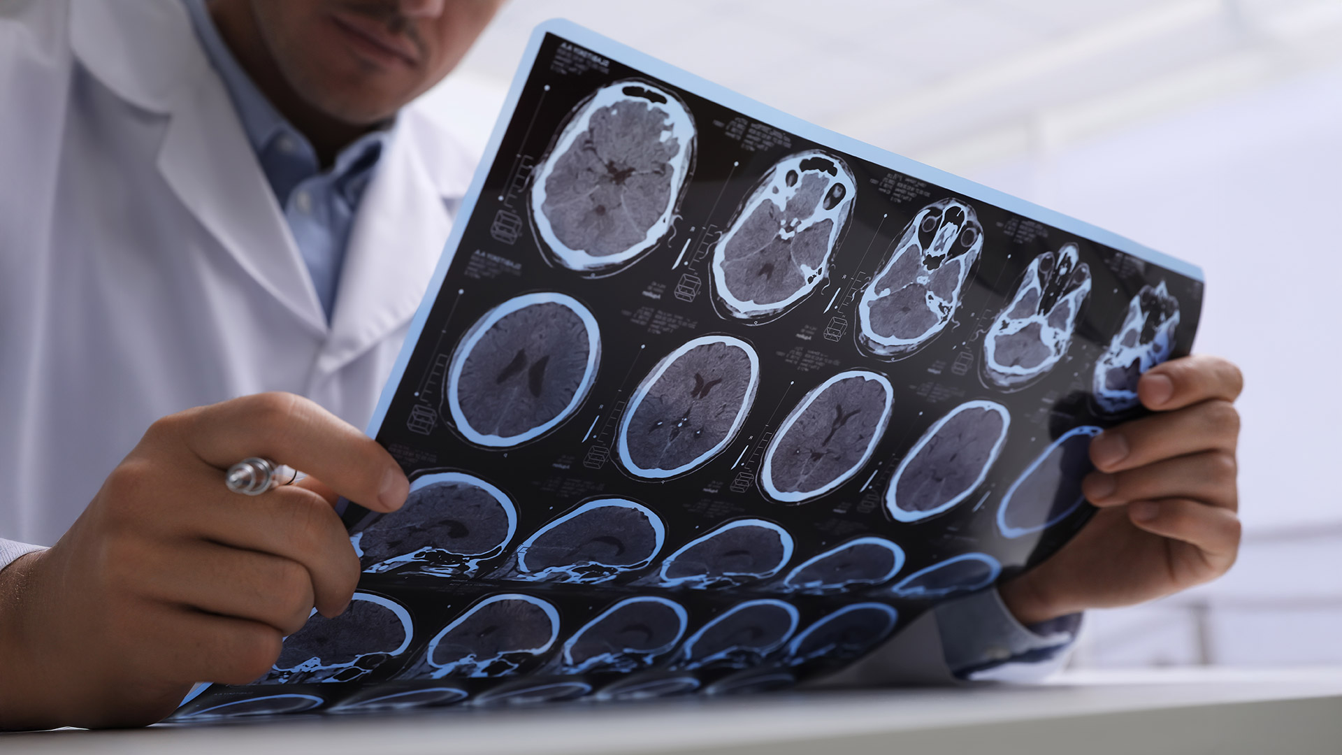 Mapeo Cerebral y Cirugía Guiada por Imagen